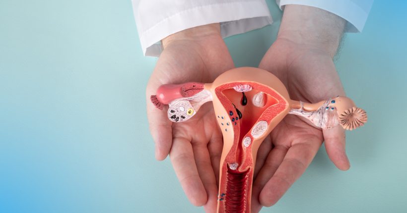 doctor Gynecologist holds model of female reproductive system in the hands. Help and care concept